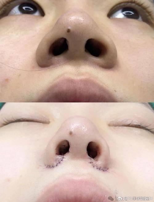 杭州佰欧克医疗美容诊所真人口碑评价怎么样？