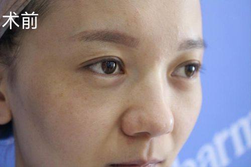 海南东湖整形美容医院收费价格表/收费标准