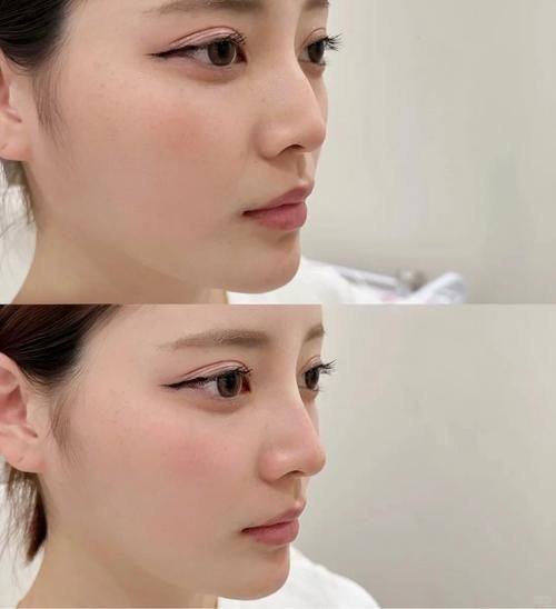 海南东湖整形美容医院详细的预约挂号方式及流程