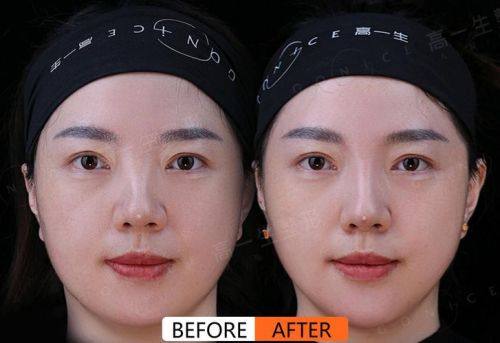 海南东湖整形美容医院真人口碑评价怎么样？