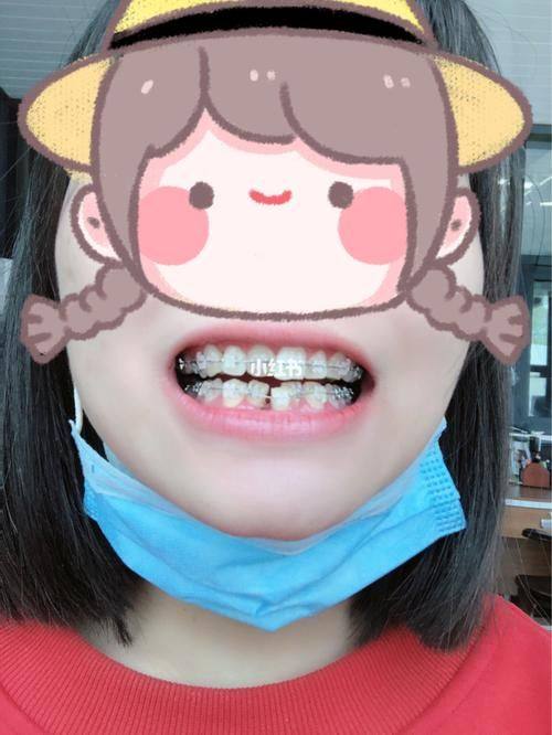 甘肃金昌张露口腔诊所详细的预约挂号方式及流程