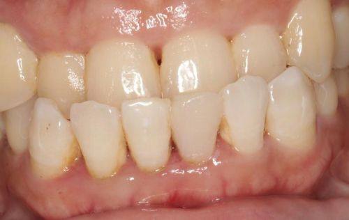 江阴摩尔口腔门诊部特色项目及技术优势