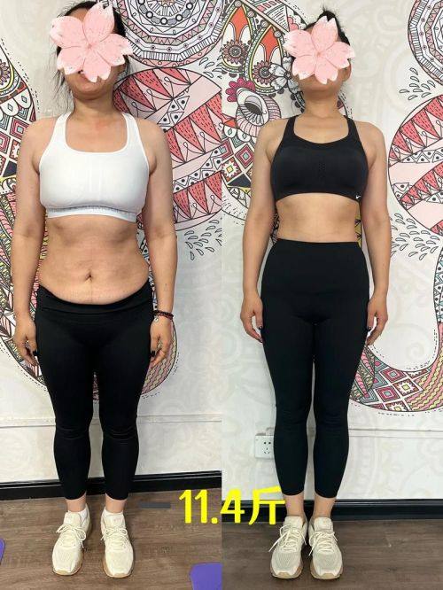 海南东湖整形医院收费价格表/收费标准