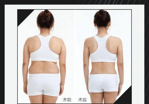 海南东湖整形医院详细的预约挂号方式及流程