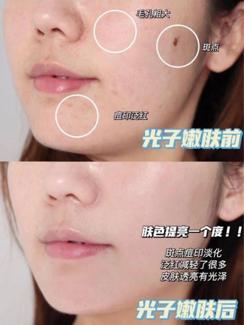 北京亚汇利整形医院真人口碑评价怎么样？