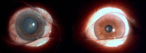 扬州明康眼科医院地址电话营业时间