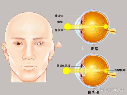 重庆医 科 大学附属永川医院眼科真人口碑评价怎么样？