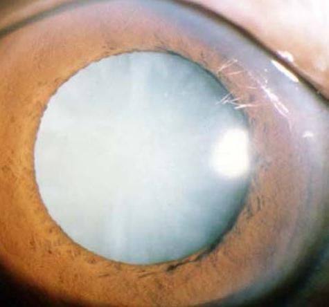 九江市妇幼保健院眼科收费价格表/收费标准