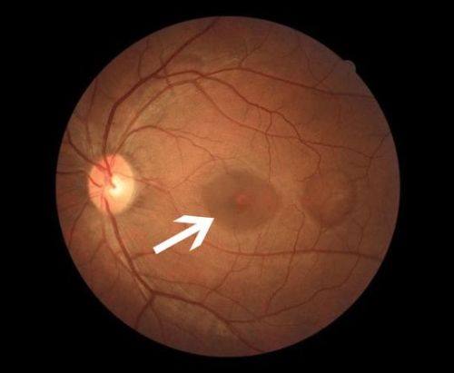 扬州明康眼科医院真人口碑评价怎么样？