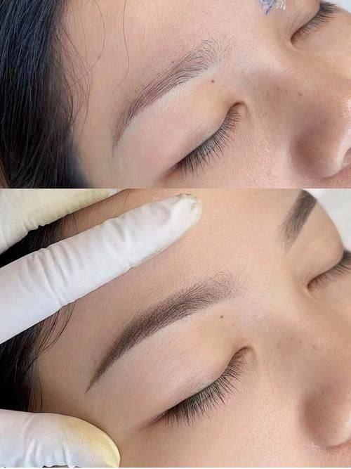 北京亚汇利整形医院特色项目及技术优势