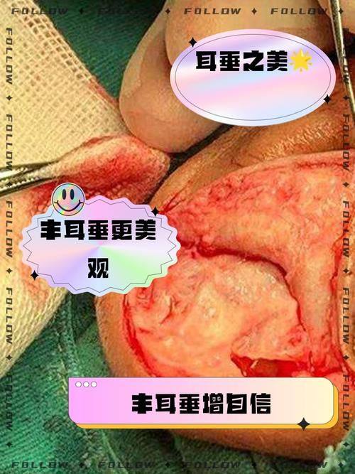 内蒙古自治区医院整形美容科特色项目及技术优势