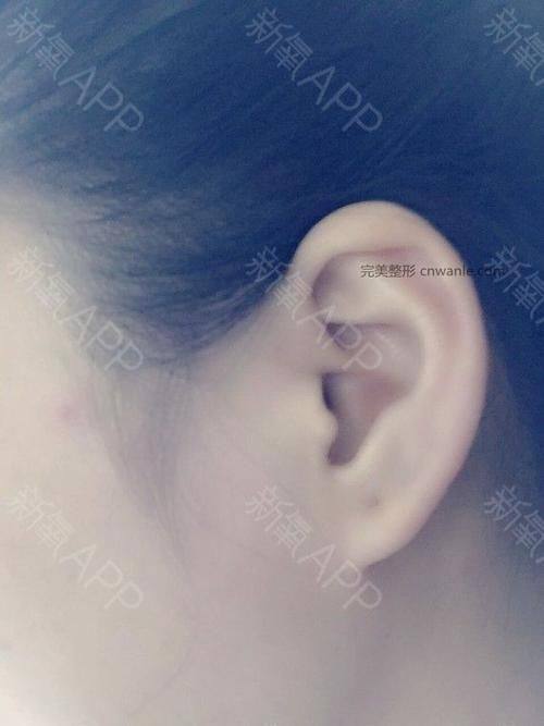 内蒙古自治区医院整形美容科收费价格表/收费标准