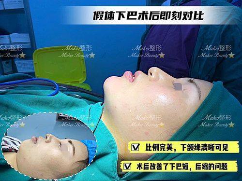 潍坊赛尔整形医院真人口碑评价怎么样？