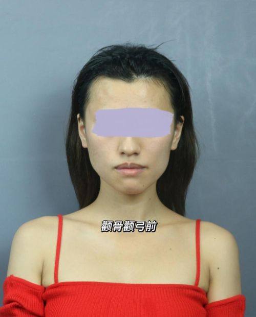 潍坊赛尔整形医院是正规医院吗？