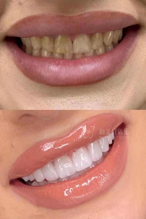 牙博士口腔麦牙店详细的预约挂号方式及流程