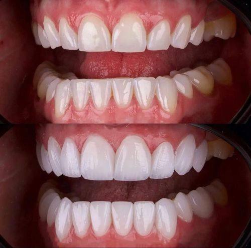 上海贝德口腔门诊部详细的预约挂号方式及流程