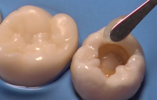 洛阳马二教口腔收费价格表/收费标准