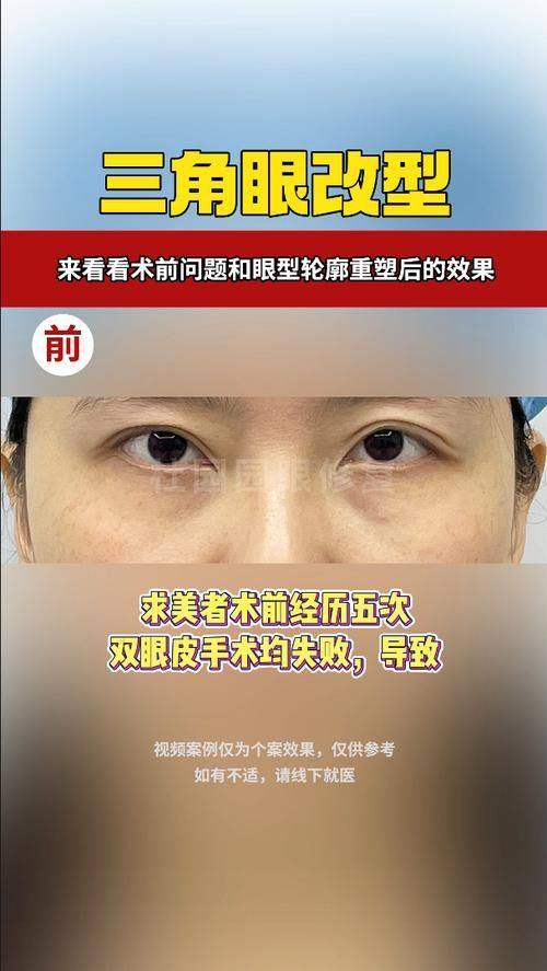 宁波心追整形医院真人口碑评价怎么样？