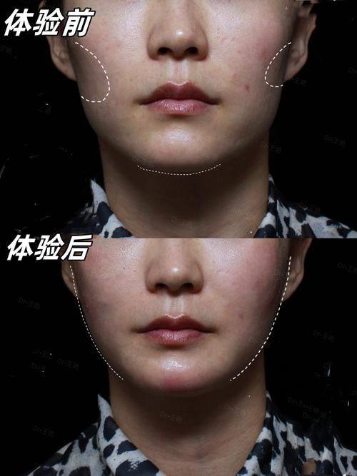 澄迈韩秀医疗美容诊所特色项目及技术优势