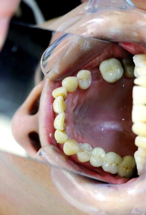 海阳志举口腔真人口碑评价怎么样?