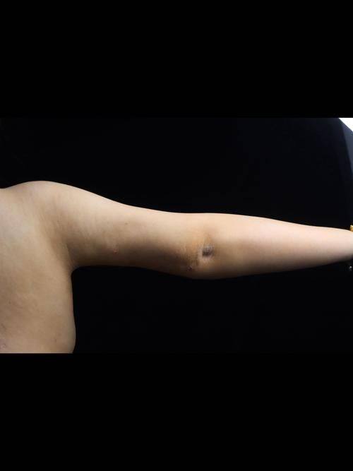 宁波心追整形医院是正规医院吗？