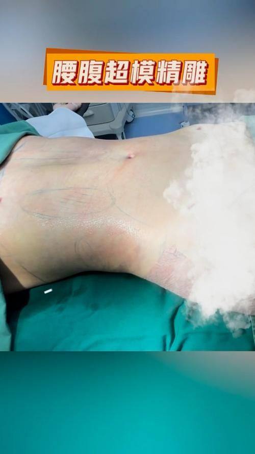 长春朝医医疗美容门诊部详细的预约挂号方式及流程