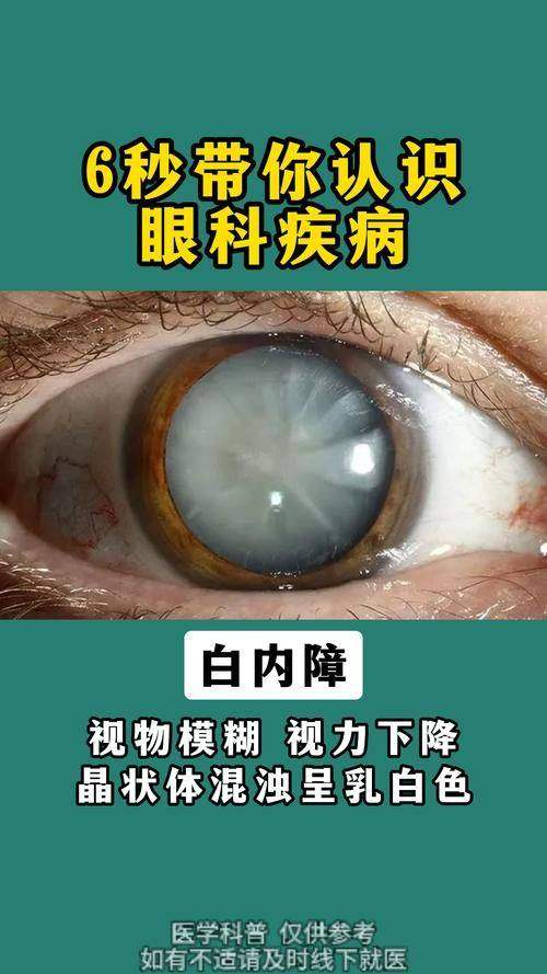 新疆医 科 大学第六附属医院眼科是正规医院吗？