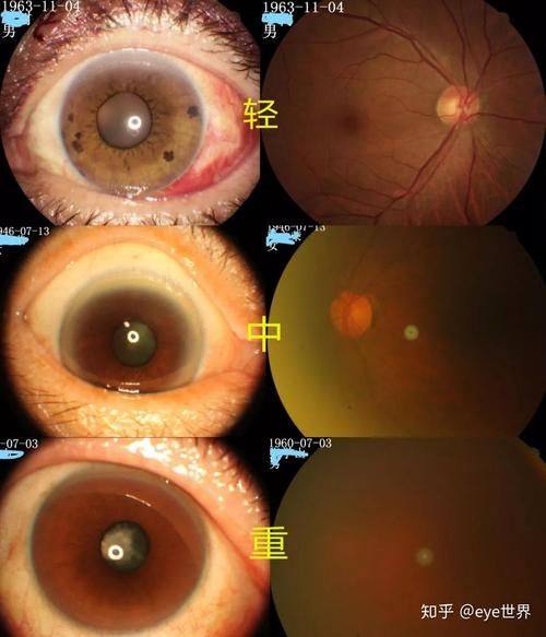 昆明阿玛施眼科门诊部真人口碑评价怎么样?