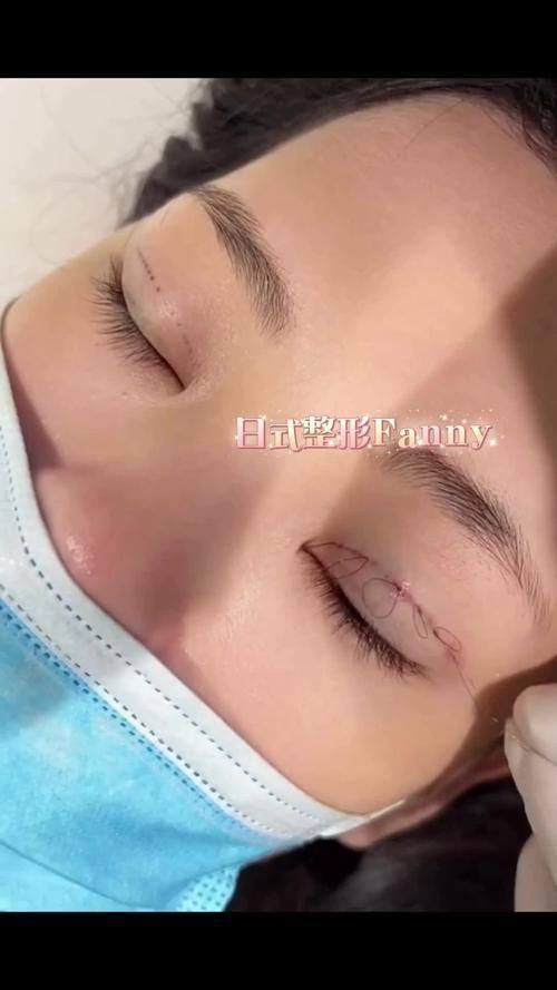 新乡魏作明医疗整形诊所真人口碑评价怎么样？