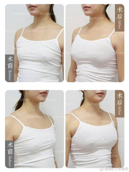 长春朝医医疗美容门诊部特色项目及技术优势