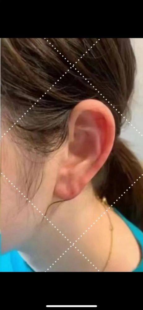 广州明丽医疗美容门诊部真人口碑评价怎么样？