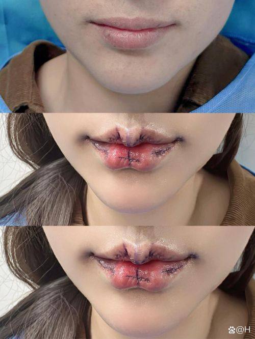 焦作爱美丽医疗美容诊所特色项目及技术优势