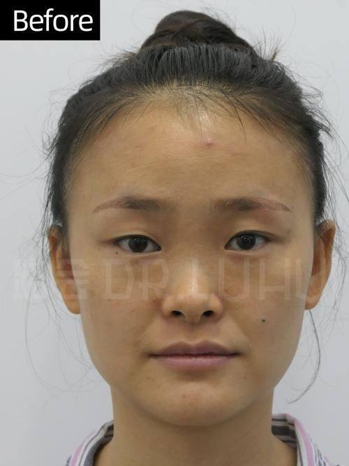 武汉东方丽人医院整形美容科地址电话营业时间