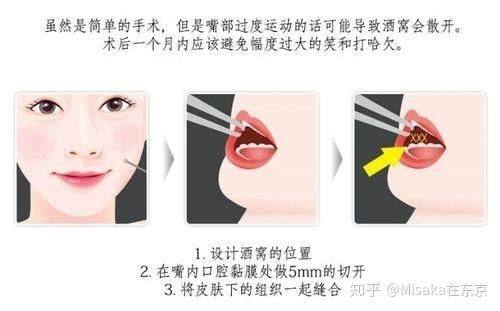 武汉东方丽人医院整形美容科真人口碑评价怎么样？