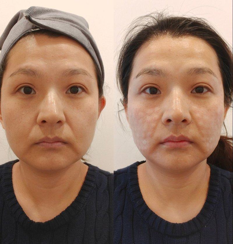 长春朝医医疗美容门诊部真人口碑评价怎么样?