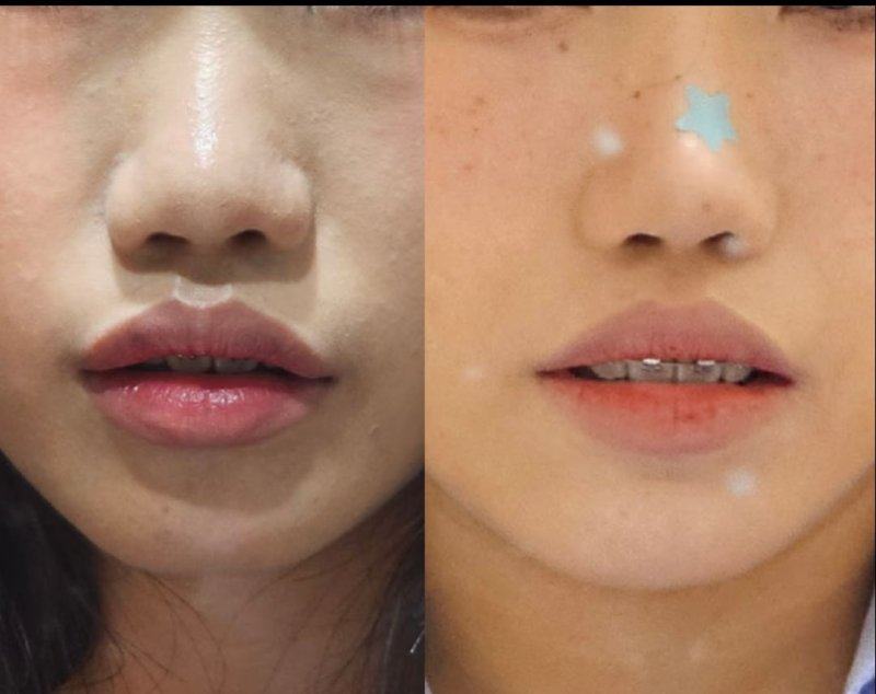 澄迈韩秀医疗美容诊所真人口碑评价怎么样？