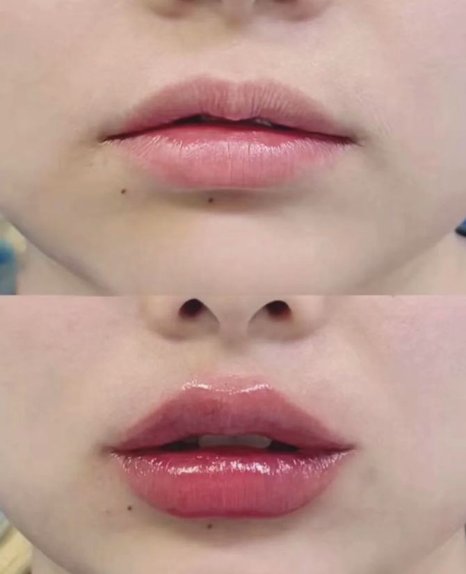 焦作爱美丽医疗美容诊所是正规医院吗？