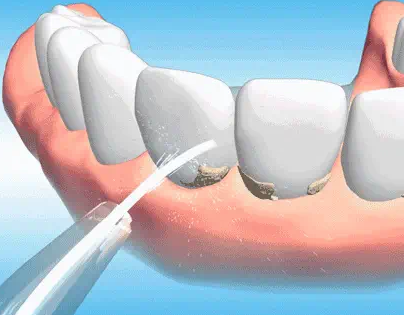 四川成都维密欧贝丽口腔门诊部收费价格表/收费标准