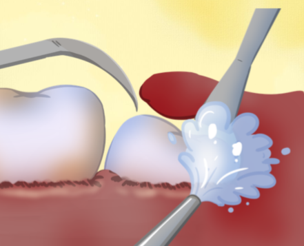 四川成都维密欧贝丽口腔门诊部特色项目及技术优势
