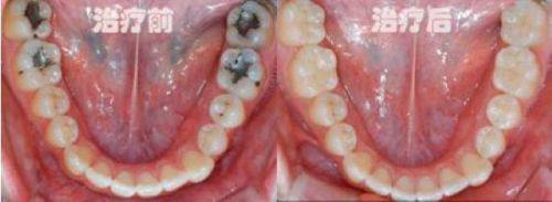 广东梅州保安堂口腔科真人口碑评价怎么样？