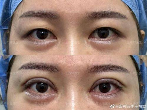 南通伊莱美整形医疗美容诊所详细的预约挂号方式及流程