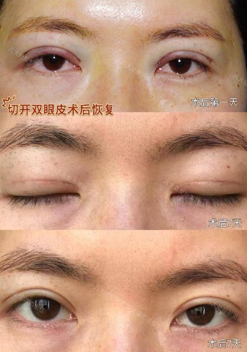 南通伊莱美整形医疗美容诊所收费价格表/收费标准