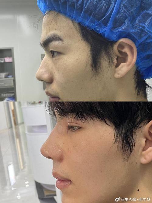 南通伊莱美整形医疗美容诊所真人口碑评价怎么样?