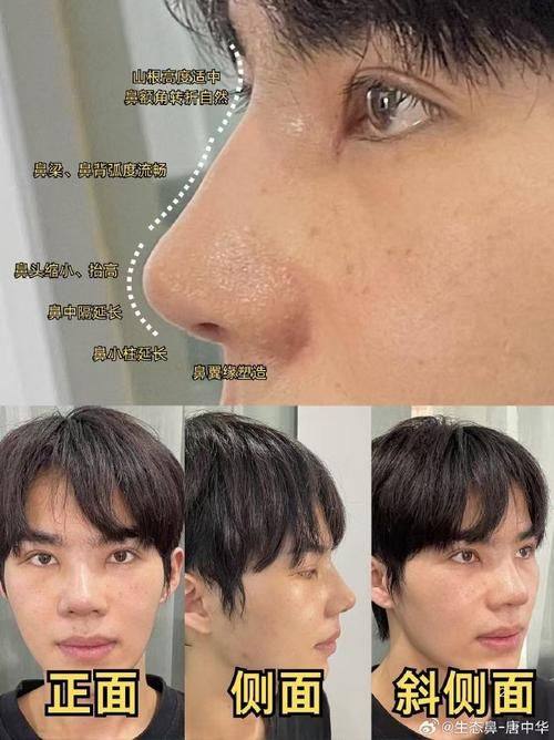 心美眼整形外科真人口碑评价怎么样？