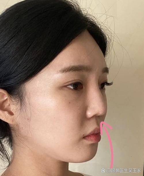 心美眼整形外科详细的预约挂号方式及流程