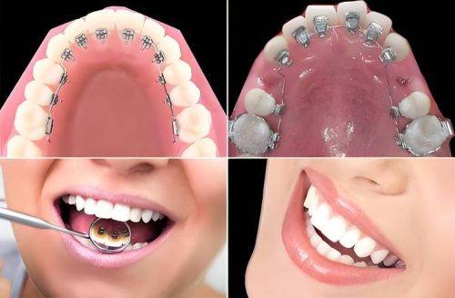 广东梅州保安堂口腔科地址电话营业时间