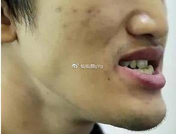 天津爱之祥口腔详细的预约挂号方式及流程