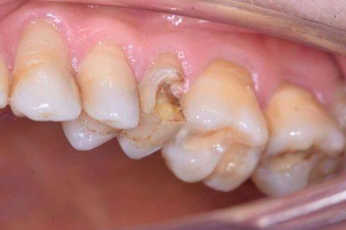 长沙牙尔美口腔诊所特色项目及技术优势