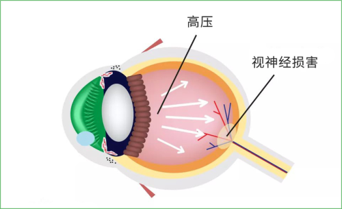 六安市人民医院眼科详细的预约挂号方式及流程