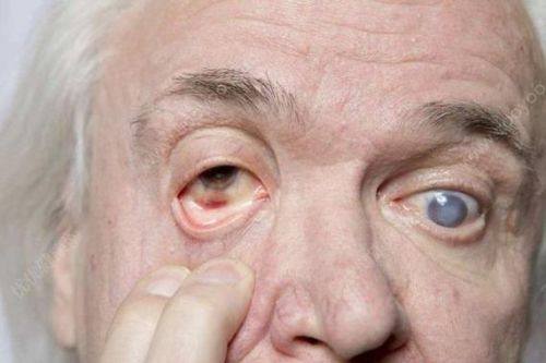 六安市人民医院眼科收费价格表/收费标准